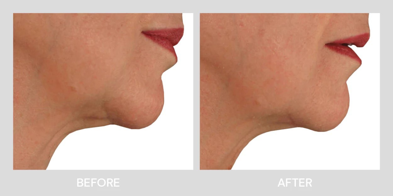 هایفو الترافورمر هفت بعدی پرتابل