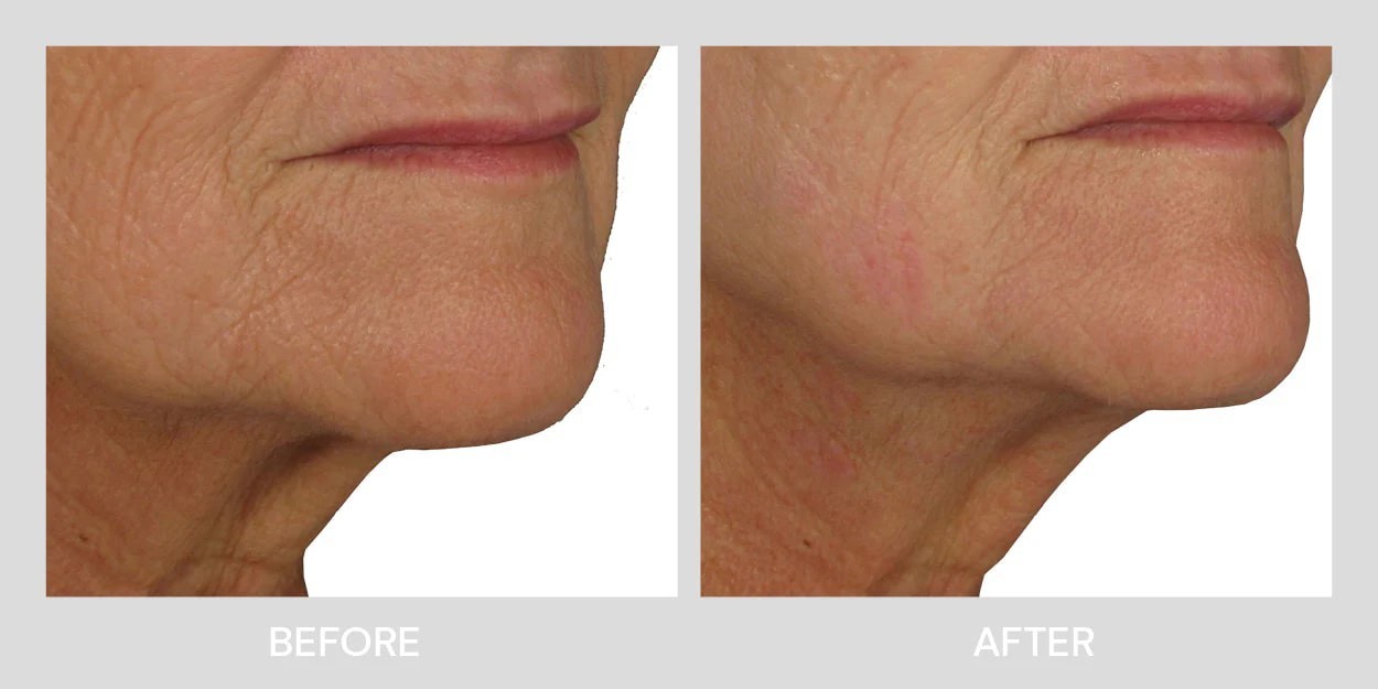 هایفو الترافورمر هفت بعدی پرتابل