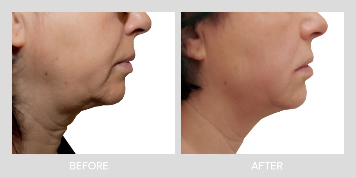 هایفو الترافورمر هفت بعدی پرتابل