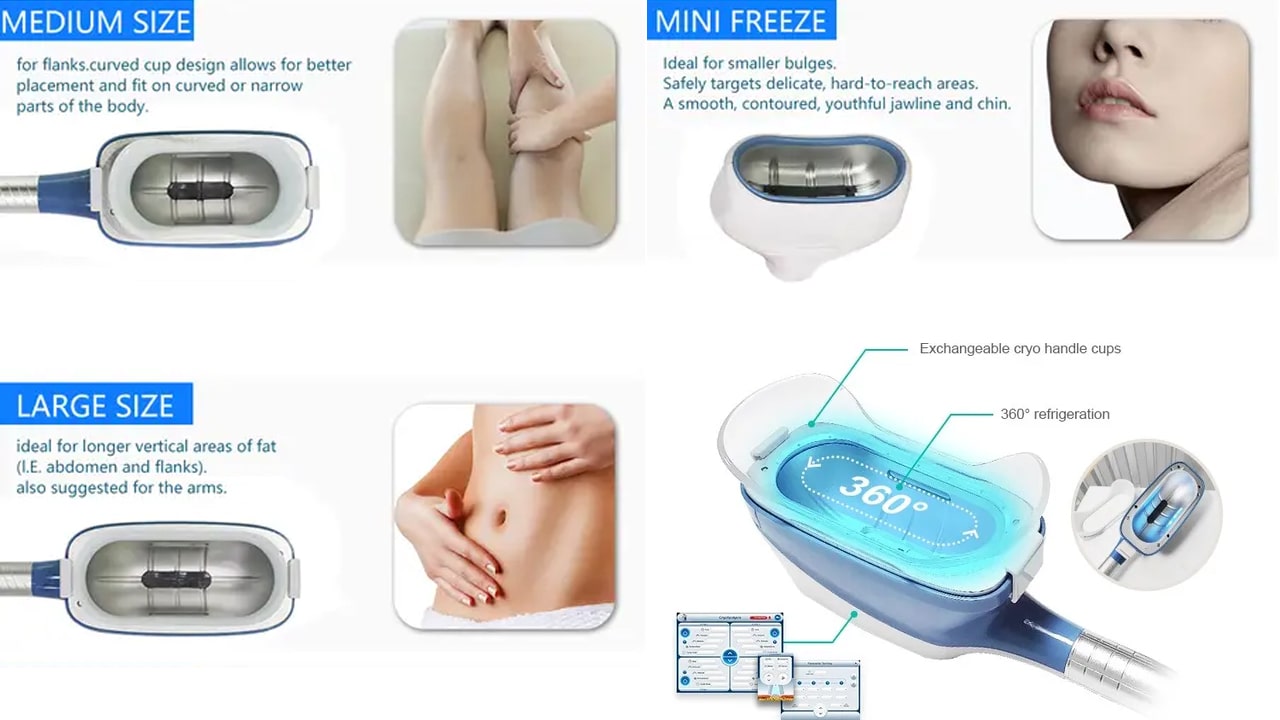 لاغری کرایولیپولیز 360 التیما