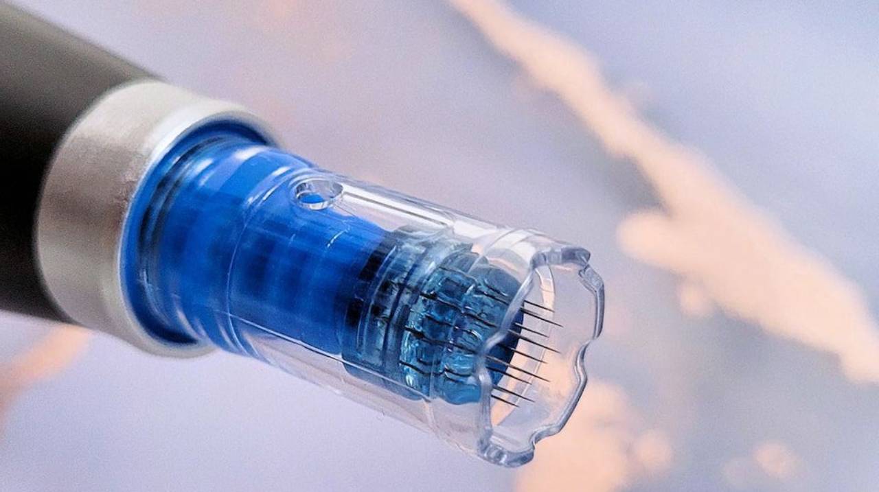 هزینه میکرونیدلینگ چقدر است؟