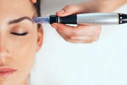 میکرونیدلینگ؛ کاربرد، مزایا و هزینه ها