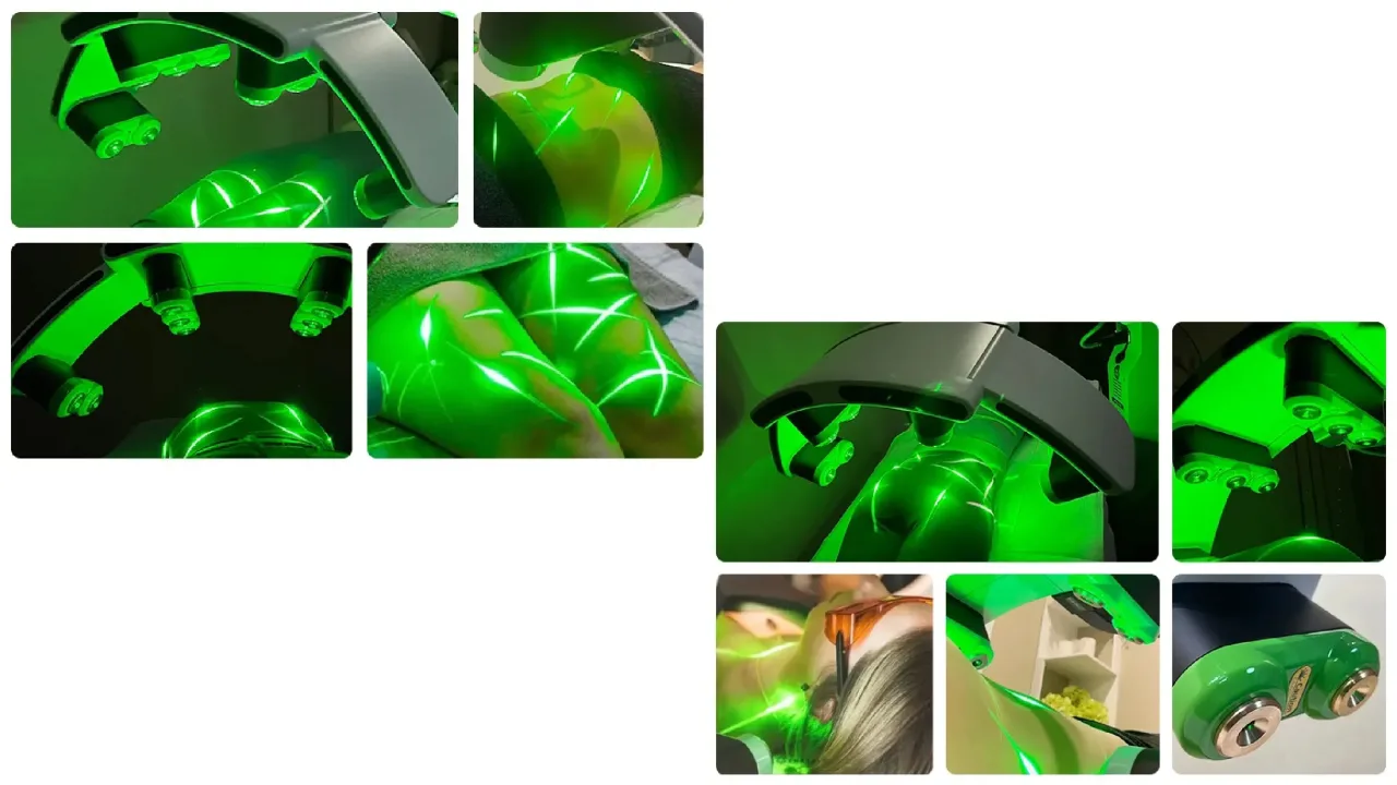 لیزر لاغری لیزر سرد لیزر سبز لاغری لیزر کم توان لاغری غیر تهاجمی و کاهش سایز